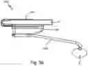 Fig. 65 - Resilient body component contact for a subcutaneous device