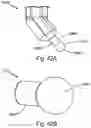 Fig. 71 - Resilient body component contact for a subcutaneous device