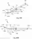 Fig. 75 - Resilient body component contact for a subcutaneous device