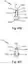 Fig. 77 - Resilient body component contact for a subcutaneous device