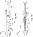 Fig. 82 - Resilient body component contact for a subcutaneous device