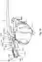 Fig. 98 - Resilient body component contact for a subcutaneous device
