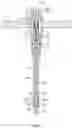 Fig. 06 - EXPANDABLE LOCKING REAMER WITH DOUBLE-SIDED BLADES