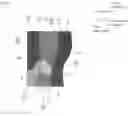 Fig. 07 - TRANSPARENT CONDUCTIVE LAYER AND TRANSPARENT CONDUCTIVE SHEET