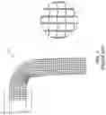 Fig. 07 - STENT WITH ANTI-MIGRATION FEATURE