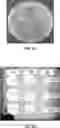 Fig. 02 - Methods and compositions for the treatment of C. difficile