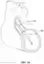 Fig. 02 - FLUID SEALS FOR CATHETER PUMP MOTOR ASSEMBLY