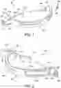 Fig. 02 - Alignment devices for use in correction of bone deformities