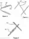 Fig. 03 - Stent and stent delivery device