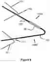 Fig. 04 - Stent and stent delivery device