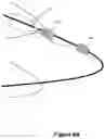 Fig. 05 - Stent and stent delivery device