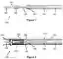 Fig. 06 - Stent and stent delivery device