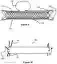 Fig. 07 - Stent and stent delivery device