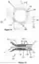 Fig. 10 - Stent and stent delivery device