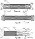 Fig. 13 - Stent and stent delivery device