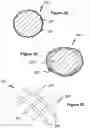 Fig. 14 - Stent and stent delivery device