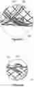 Fig. 31 - Stent and stent delivery device