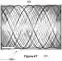 Fig. 33 - Stent and stent delivery device