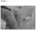 Fig. 03 - PLUG FOR LUNG TISSUE TRACT SEALING