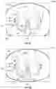 Fig. 09 - Systems for post-processing additively manufactured objects