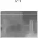 Fig. 04 - Image encoding method using a skip mode, and a device using the method