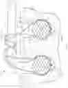 Fig. 20 - METHOD OF SOFT ANCHOR KNOTLESS REPAIR