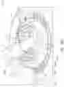 Fig. 35 - INTRAOCULAR LENS DEVICE AND RELATED METHODS