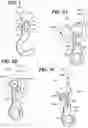 Fig. 02 - Ligature attachment device