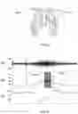 Fig. 02 - A SYSTEM AND METHOD FOR DETERMINING RESPIRATORY EFFORT