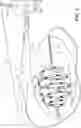 Fig. 02 - Percutaneous coiled catheter design for gallbladder cryoablation