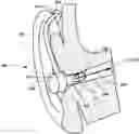 Fig. 01 - Apparatus and method for performing active occlusion cancellation with audio hear-through