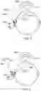 Fig. 03 - Apparatus and method for performing active occlusion cancellation with audio hear-through