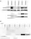 Fig. 09 - EPLIN AS A BIOMARKER FOR CANCER