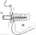 Fig. 01 - DEVICES AND METHODS OF TREATING ORAL TISSUES