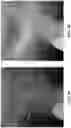 Fig. 06 - DEVICES AND METHODS OF TREATING ORAL TISSUES