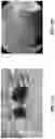Fig. 07 - DEVICES AND METHODS OF TREATING ORAL TISSUES