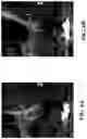 Fig. 08 - DEVICES AND METHODS OF TREATING ORAL TISSUES