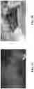 Fig. 09 - DEVICES AND METHODS OF TREATING ORAL TISSUES
