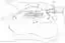 Fig. 01 - Micro Incisional Manual Cataract Surgery