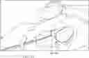 Fig. 09 - LARGE AREA HEMOSTASIS WITH VESSEL SEALING