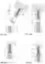 Fig. 07 - Hollow-cylindrical preloading cartridge for an installation tool of a wire thread insert, the installation tool, a retrofit kit with hollow-cylindrical preloading cartridges for it as well as an installation method for the wire thread insert