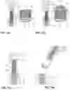 Fig. 08 - Hollow-cylindrical preloading cartridge for an installation tool of a wire thread insert, the installation tool, a retrofit kit with hollow-cylindrical preloading cartridges for it as well as an installation method for the wire thread insert