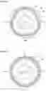 Fig. 05 - Strain wave gearing