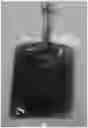 Fig. 01 - PARENTERAL DOSAGE FORM OF CARBOPLATIN