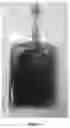 Fig. 04 - PARENTERAL DOSAGE FORM OF CARBOPLATIN
