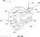 Fig. 09 - DEVICE FOR APPLYING FLUID TO LEAFLETS OF A HEART VALVE PROSTHESIS DURING CRIMPING