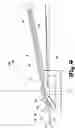 Fig. 05 - FLOATING WIND TURBINE SYSTEMS AND METHODS