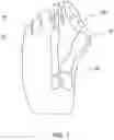 Fig. 02 - Device and surgical technique for foot surgery