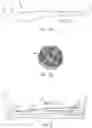 Fig. 02 - DEVICES AND METHODS FOR TREATING A FISTULA