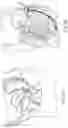 Fig. 09 - DEVICES AND METHODS FOR TREATING A FISTULA